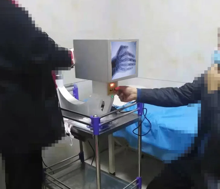 Small C Arm X-ray Machine/ Portable Fluoroscopy Radiography  with Large Screen