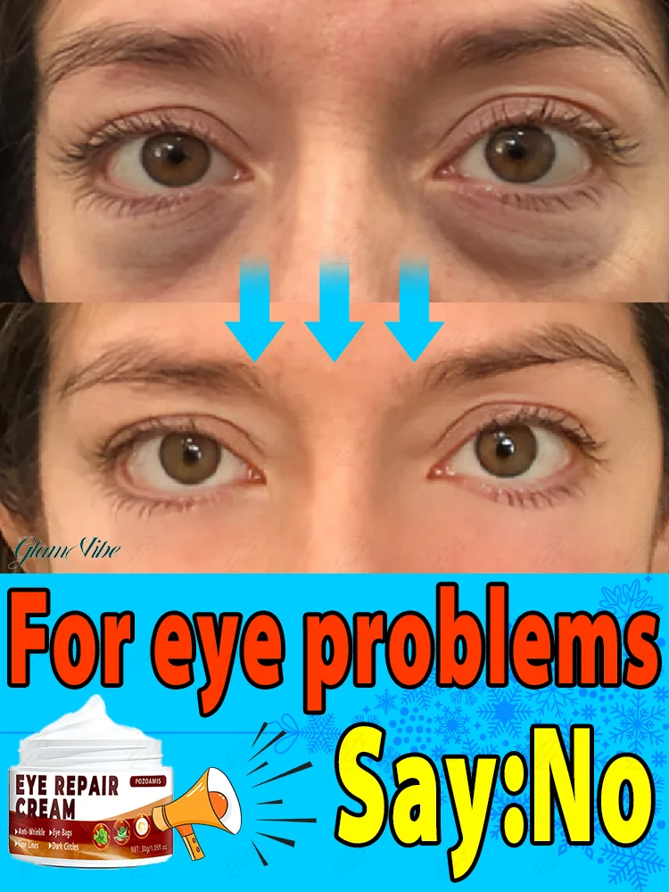 

ᴸⁱᶠᵗⁱⁿᵍ ᵉʸᵉ ᶜʳᵉᵃᵐ⸴ ᵗʰᵉ ᵗᵉʳᵐⁱⁿᵃᵗᵒʳ ᵒᶠ ᵉʸᵉ ᵇᵃᵍˢ ᵃⁿᵈ ᵈᵃʳᵏ ᶜⁱʳᶜˡᵉˢ⸴ ᵐᵃᵏᵉˢ ᵗʰᵉ ˢᵏⁱⁿ ᵃʳᵒᵘⁿᵈ ᵗʰᵉ ᵉʸᵉˢ ᵃˢ ᵈᵉˡⁱᶜᵃᵗᵉ ᵃˢ ᵃⁿ ¹⁸⁻ʸᵉᵃʳ⁻ᵒˡᵈ