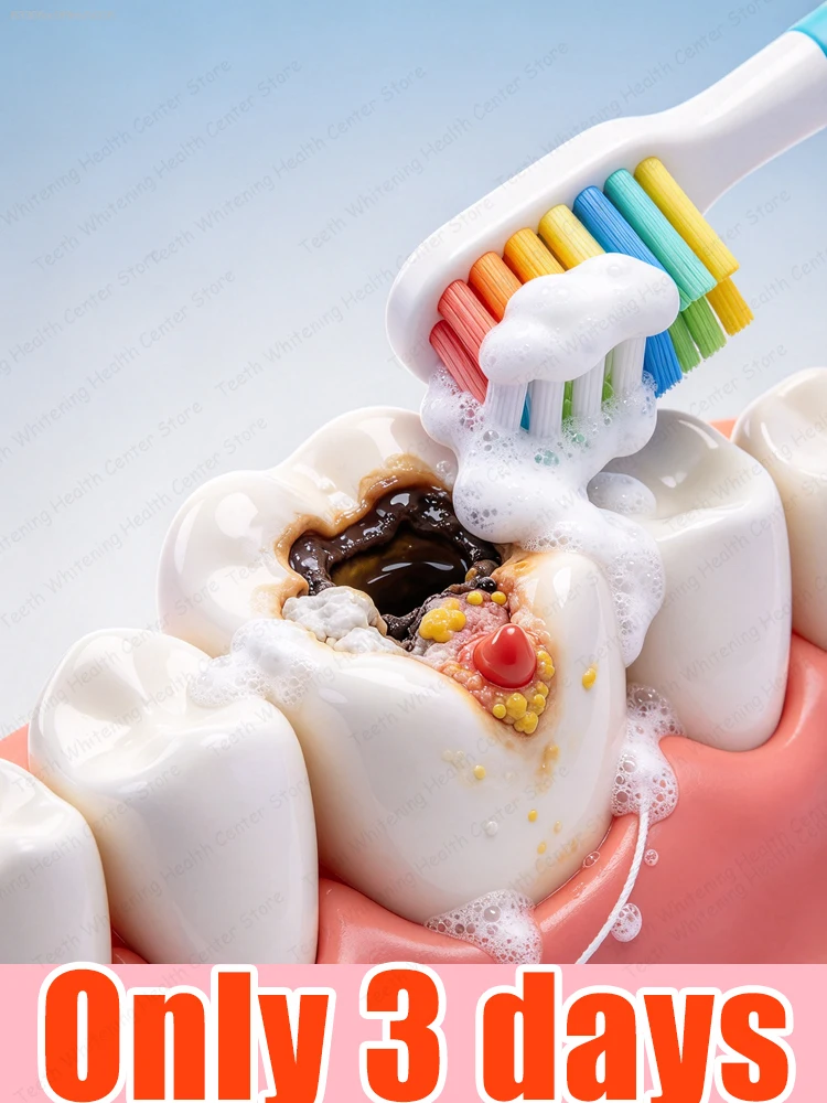 Ремонт кариеса Toothpaste That 99% of People Trust and Will Repurchase.