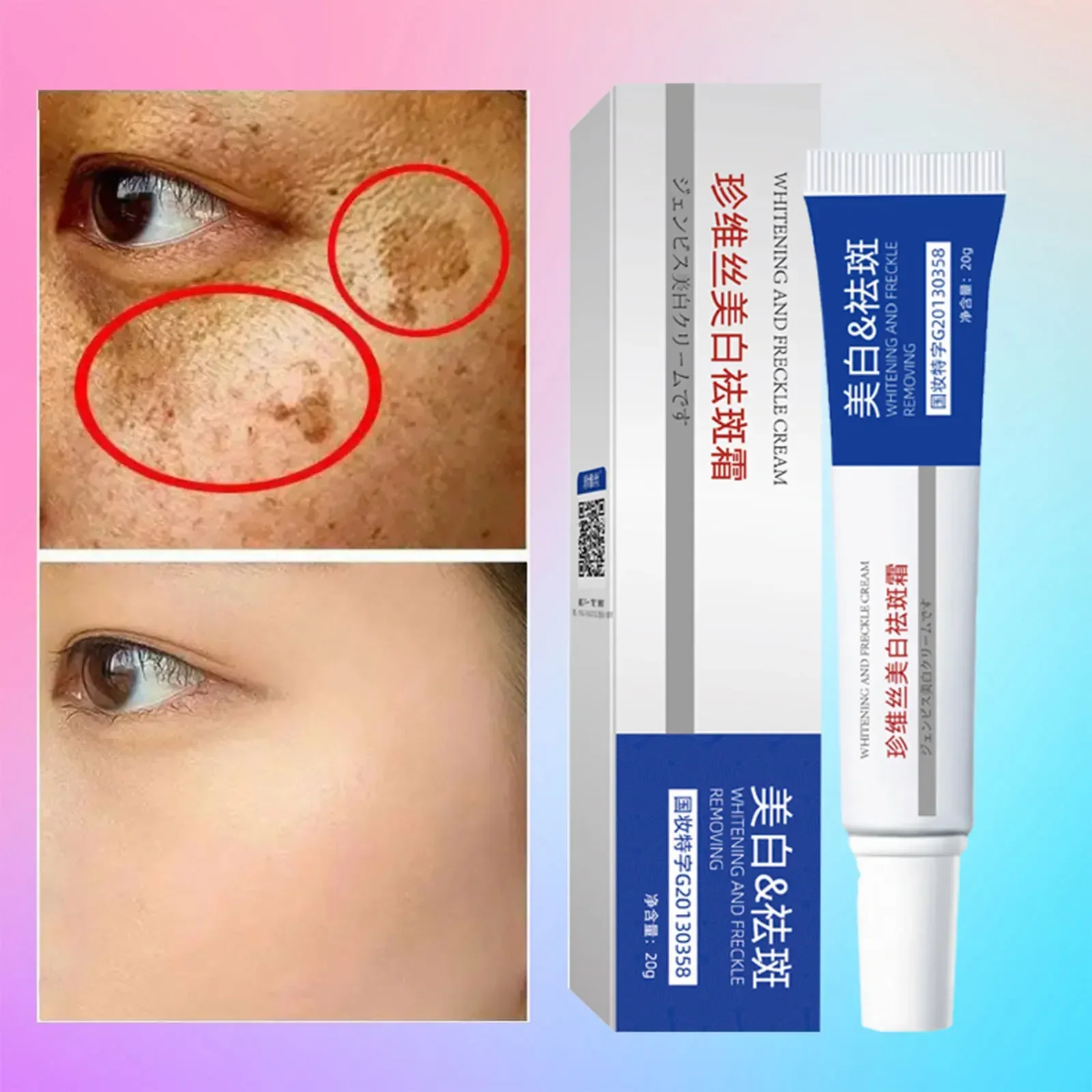 

Freckle Whiten Cream Effective Removing Spot Eliminate Brown Stain Melasma Melanin Blemishes Lighten Moisturiser Face Skin Care