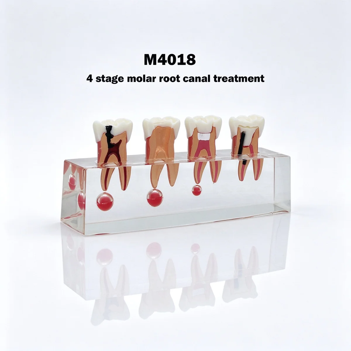 Dental Teaching Model Dentistry Endodontic Treatment Model For Doctor Patient Communication Root Canal Anatomy Clear Study Demo