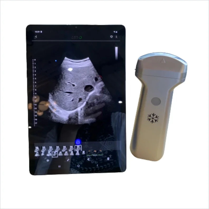 

128 Element wireless portable ultrasound probe convex transducer ultrasonic scanner transductor ultrasonido convex probe