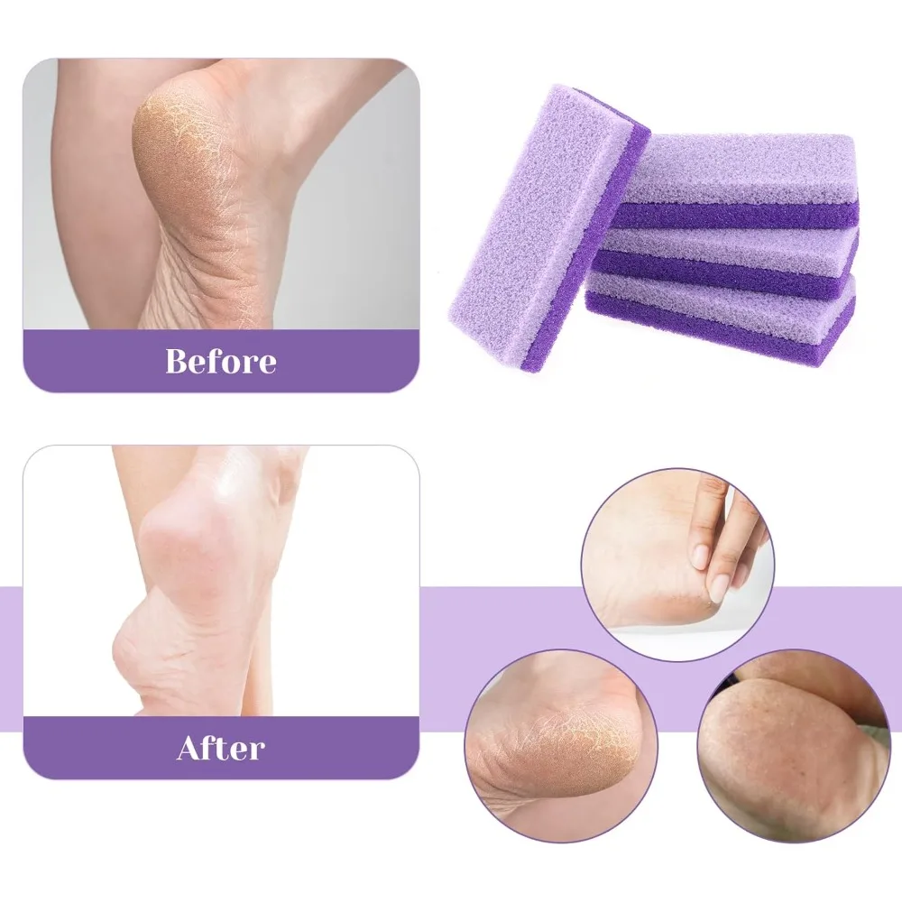 5 szt. Kamień pumeksowy do stóp, gąbki do usuwania odcisków, martwego naskórka, akcesoria do pedicure do użytku domowego, narzędzie do naprawy pięt
