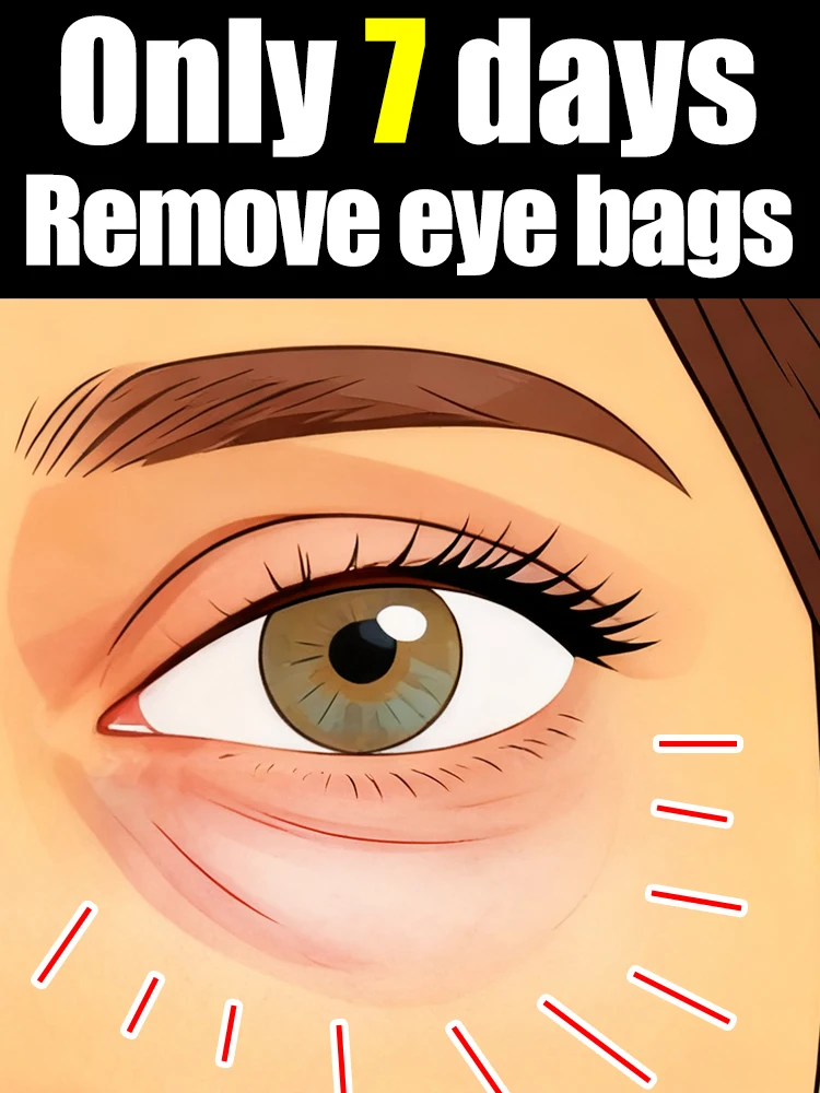 

Generation-2 gel Says Goodbye To Your Troubled In 7 Days