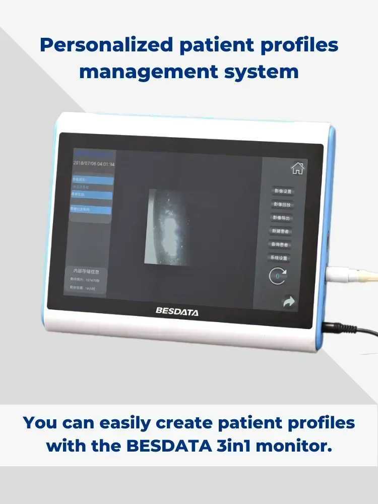 BESDATA 10.1inch  touchscreen por HD image processor for ureteroscope and cystoscope  system