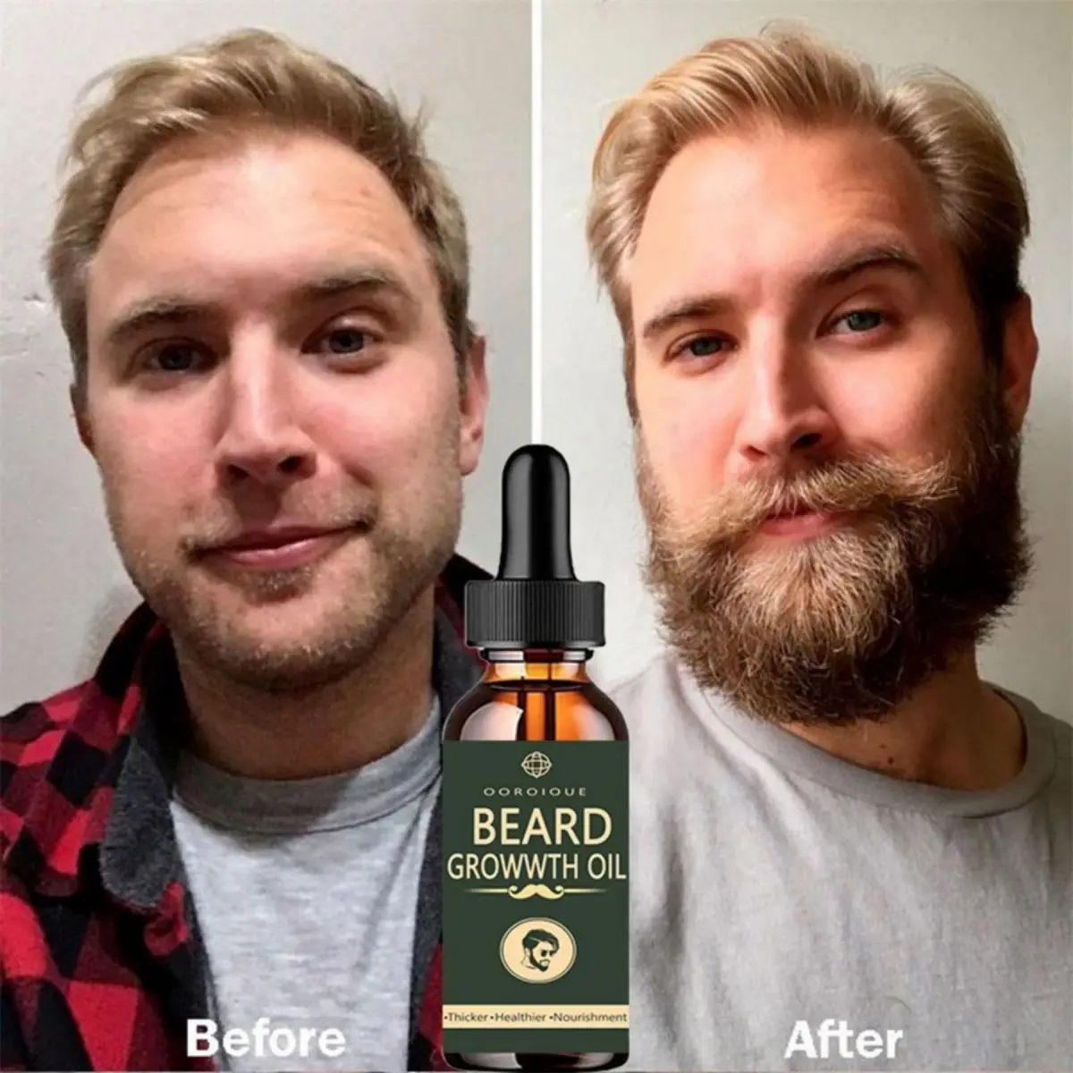 Óleo De Crescimento De Barba Rápida para Homens, Soro De Crescimento De Barba Natural De Cafeína, Promova o crescimento do cabelo, Queratina Brasileira Profissional