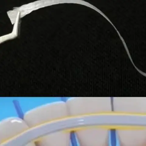 1Pcs Dental Material Flexible Fiber Strip Glass Splint Loose Tooth Fixation Strips Light Cure Bonding Orthodontic Retainers