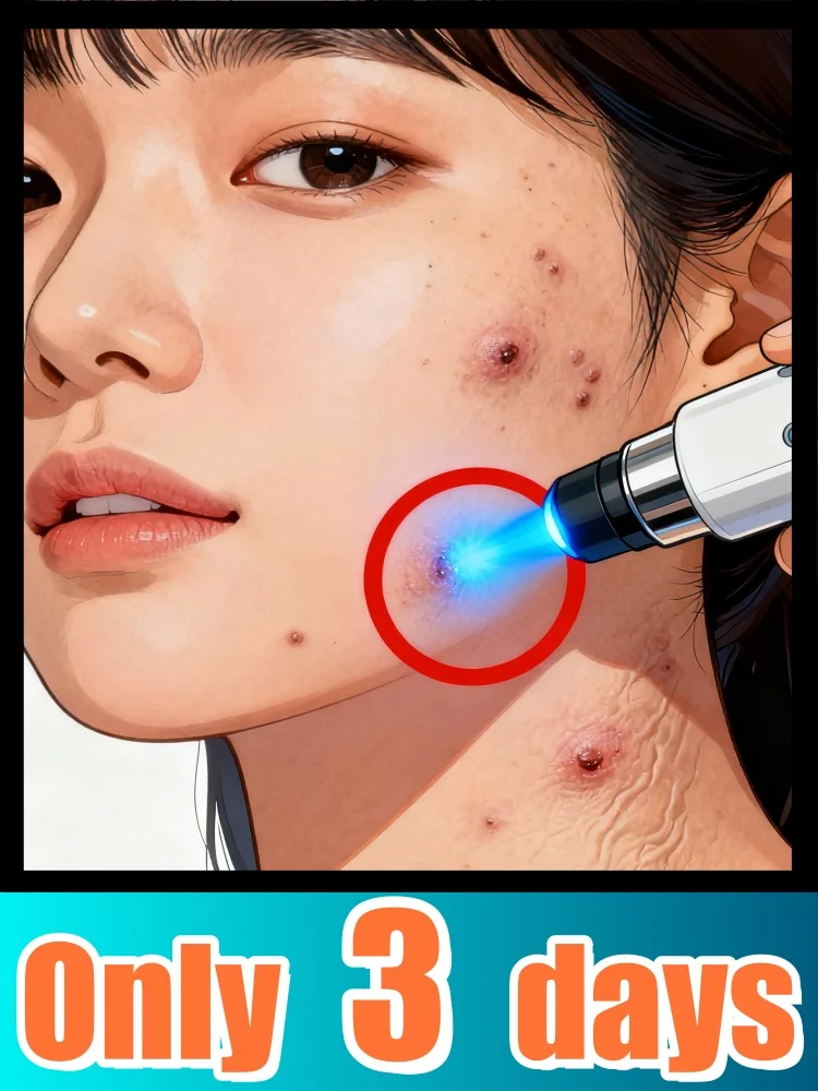 

Convenient tools for warts in 2025: Maintain eggshell-smooth skin