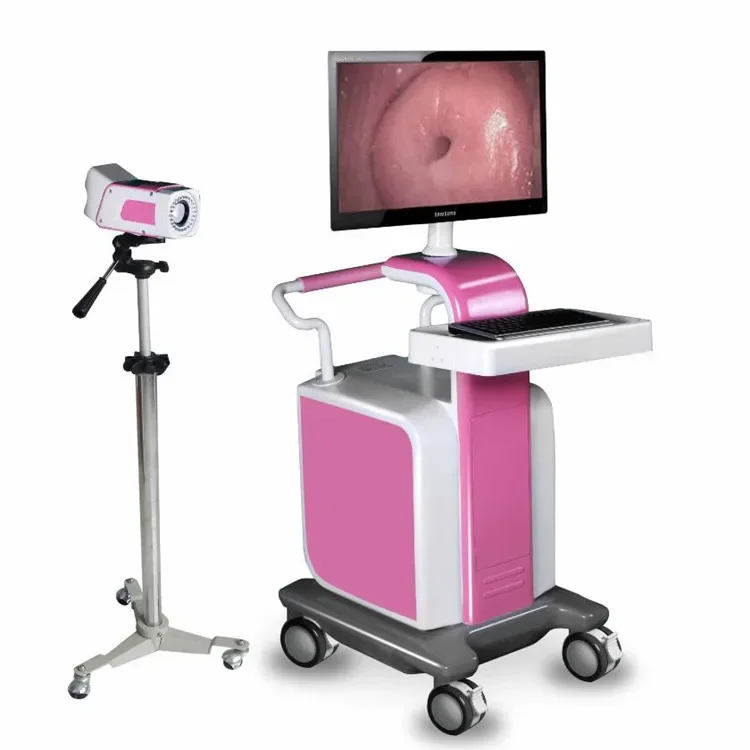 YSSW3304 Ysenemd HD Specialized Digital Optical colposcope workstation mobile 4k  for gynecology trolley