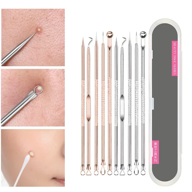 4pcs Acne Blackhead Removal Tweezers Stainless Pimple Spot ComedonesExtractor Beauty Face Clean Care Tools Facial Pore Cleanser