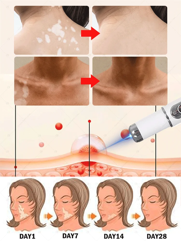 sa1564af61sa1d51a6s51