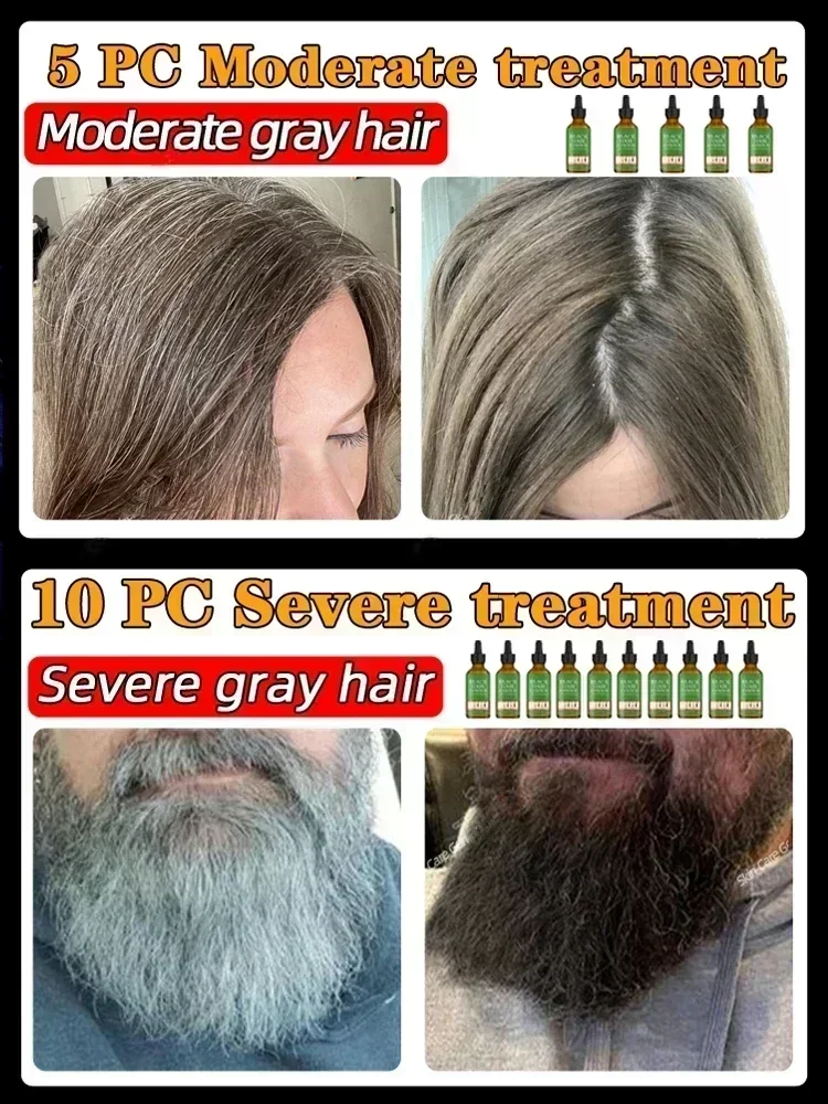 Anti-grey hair essence Serum treatment restore natural hair color and restore healthy White To Black hair