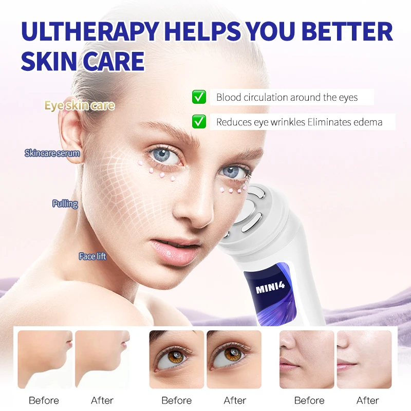 MINI HIFU 4.0 超音波マッサージャー マイクロカレントパルス 顔の肌の引き締めと引き締め効果 アイマッサージ スキンケア美容機器
