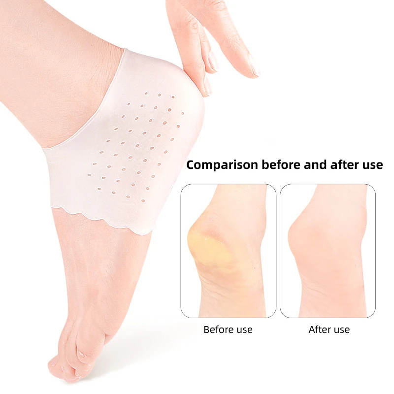 Protector de silicona para la cubierta del talón, Corrector de juanete, fascitis Plantar, alivio del dolor de pies, ortesis para el cuidado y pedicura, 2 piezas = 1 par