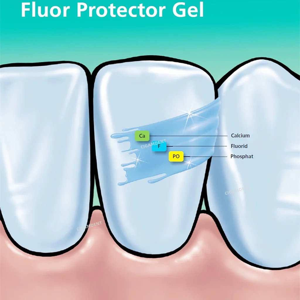 Vivadent AG Fluor Protector Dental Fluoride Varnish Gel 0.4ml Teeth Sensitive Desensitizing Protective Oral Care