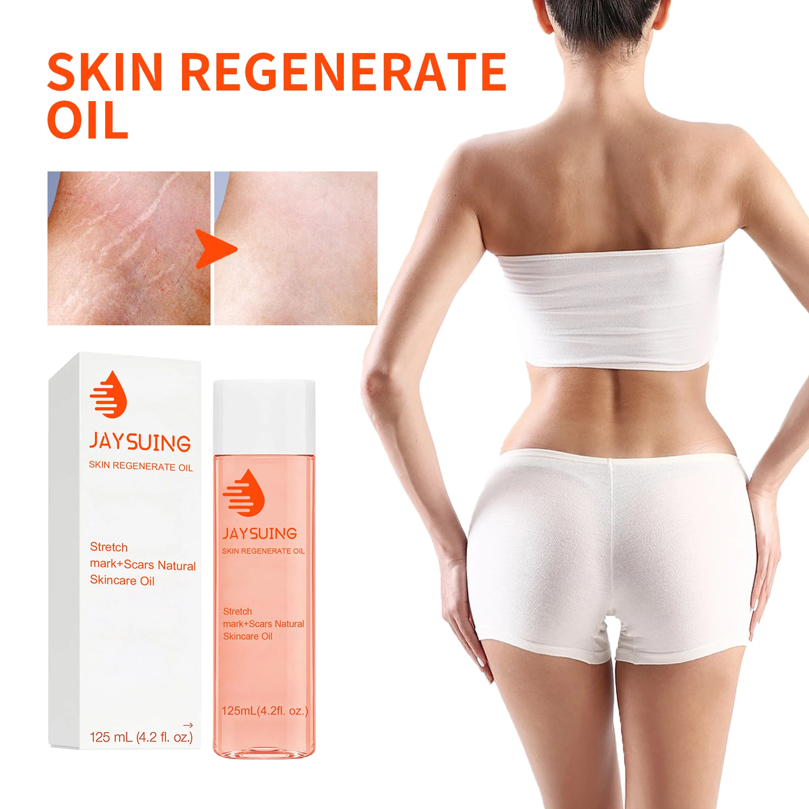 

Масло для восстановления шрамов, разглаживает шрамы, увлажняет, питает, подтягивает и повышает эластичность кожи. Эфирное масло для ухода за кожей тела