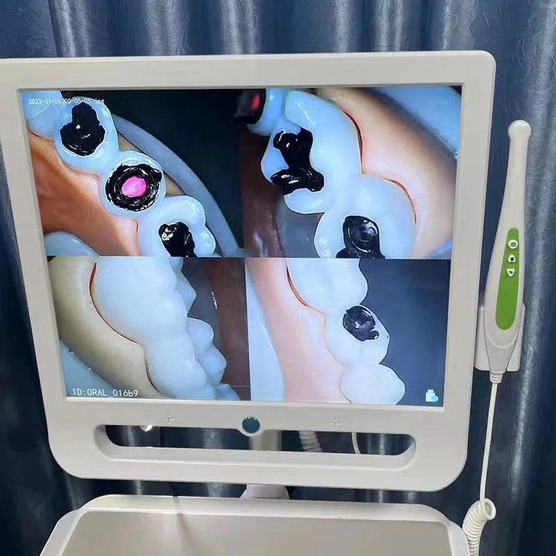 

WIFI USB Wireless Digital Intraoral Endoscop with Monito WIFI Denta Equipments Including Bracket and Camera