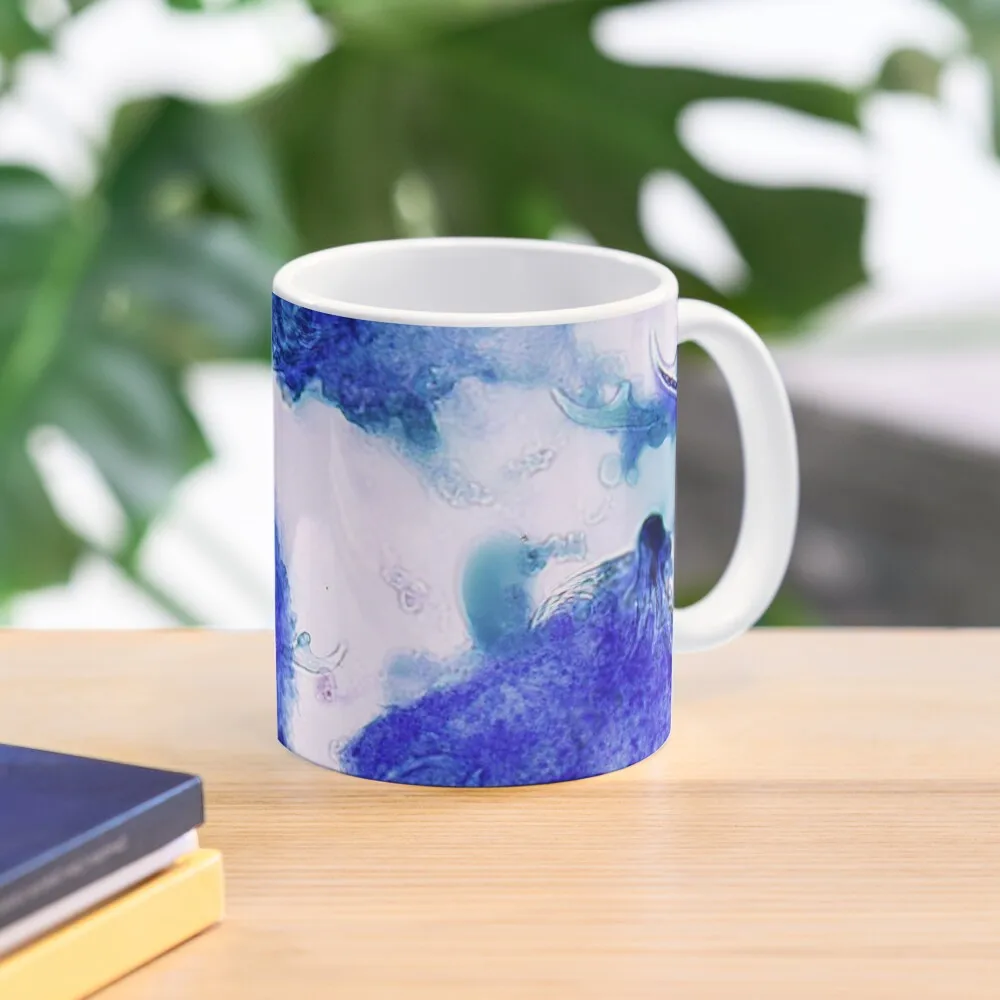 

Кофейная кружка Echinococcus granulosus, милые и разные чашки, чайные чашки, чашки и кружка