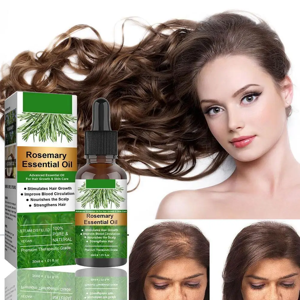 Rosemary-óleo essencial para cuidados com o cabelo, crescimento do cabelo, crescimento do cabelo, 30/50/60ml, crescimento do cabelo, perda de cabelo, perda de cabelo, perda de cabelo, crescimento do cabelo