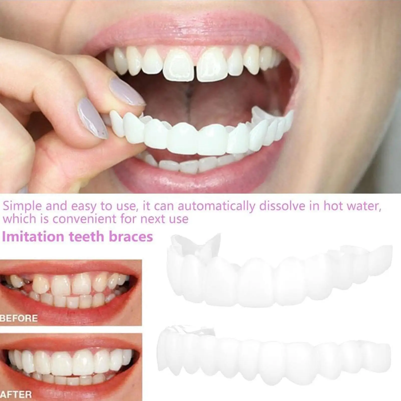 2 Piezas de Carillas Dentales Temporales para Hombre y Mujer, Carillas Superiores e Inferiores, Mejora Temporal del Sonrisa, Cubierta Reutilizable para Dientes Postizos, Blanqueamiento Dental