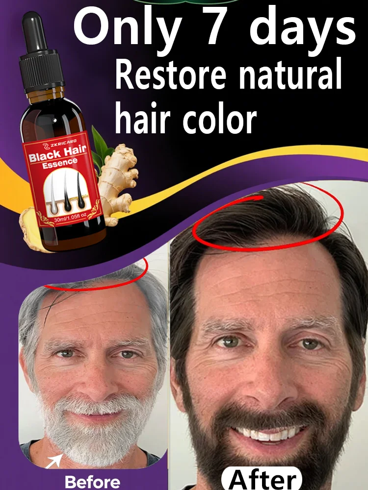 

Natural Anti-Gray Hair Serum - Prevents and Restores Black Hair's Lustrous Texture | 4-Week Herbal Results | Vegan Formula |