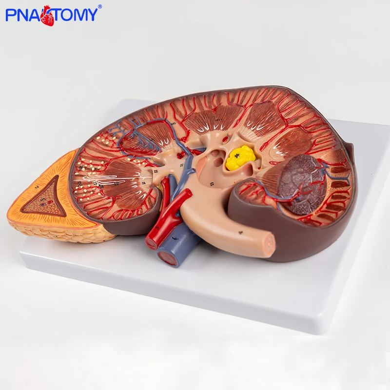 

Enlarged kidney Model with Renal Anatomy Attached to a Human Medical Anatomical Model Including an Enlarged Adrenal Gland Model