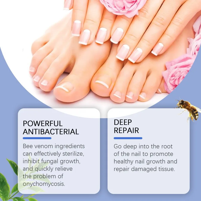 Bee Venom Nail Fungus Care Solution Surface Cleansing Repair Damaged Dry Rough Nails Hand and Foot Nail Daily Care Solution