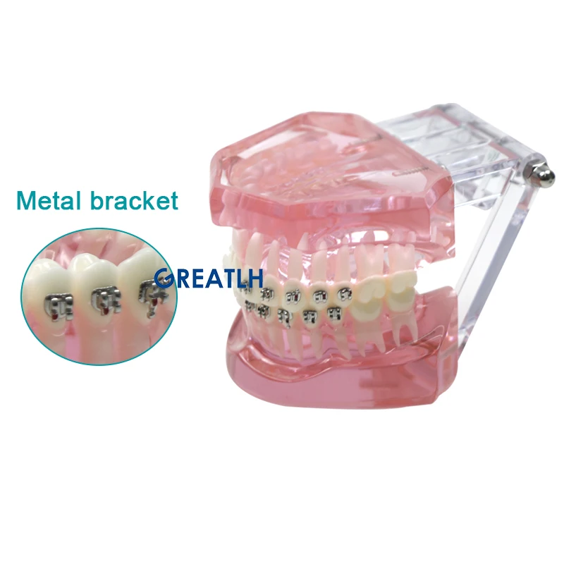 Typodont Orthodontic Model with Metal Ceramic Bracket Teaching Demonstration Model Dental Lab Tools