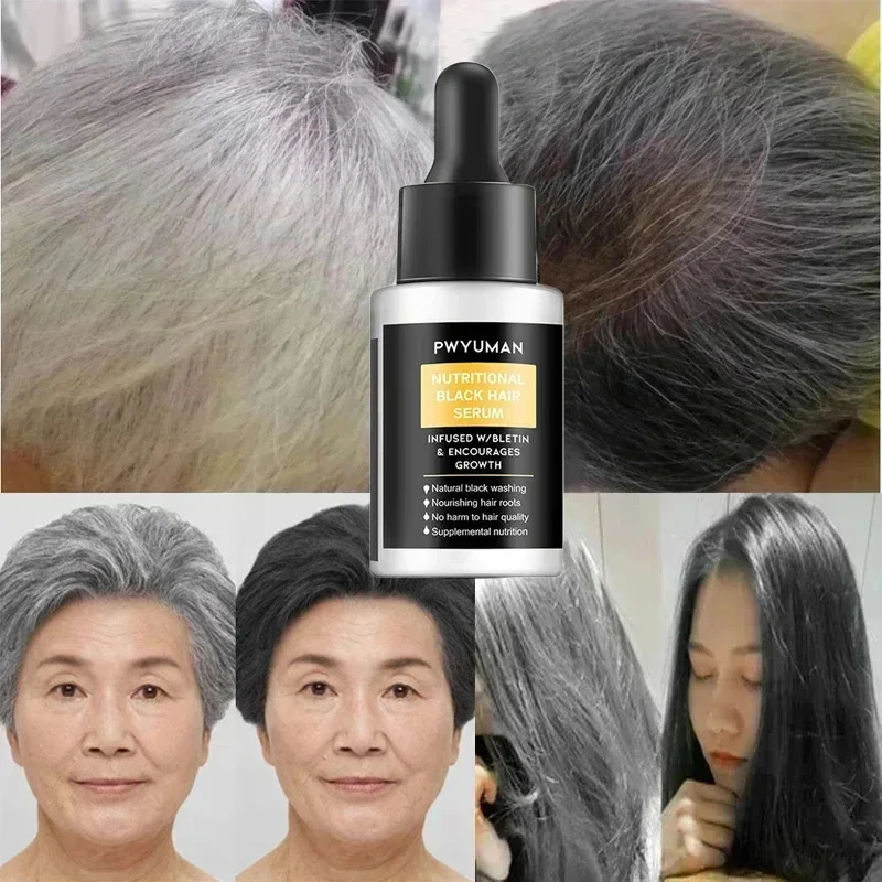 Gray White Hair Treatment Serum White Black Natural Color Hair Growth Oils Fast Regrowth Anti Hair Loss Beauty Health Women Men