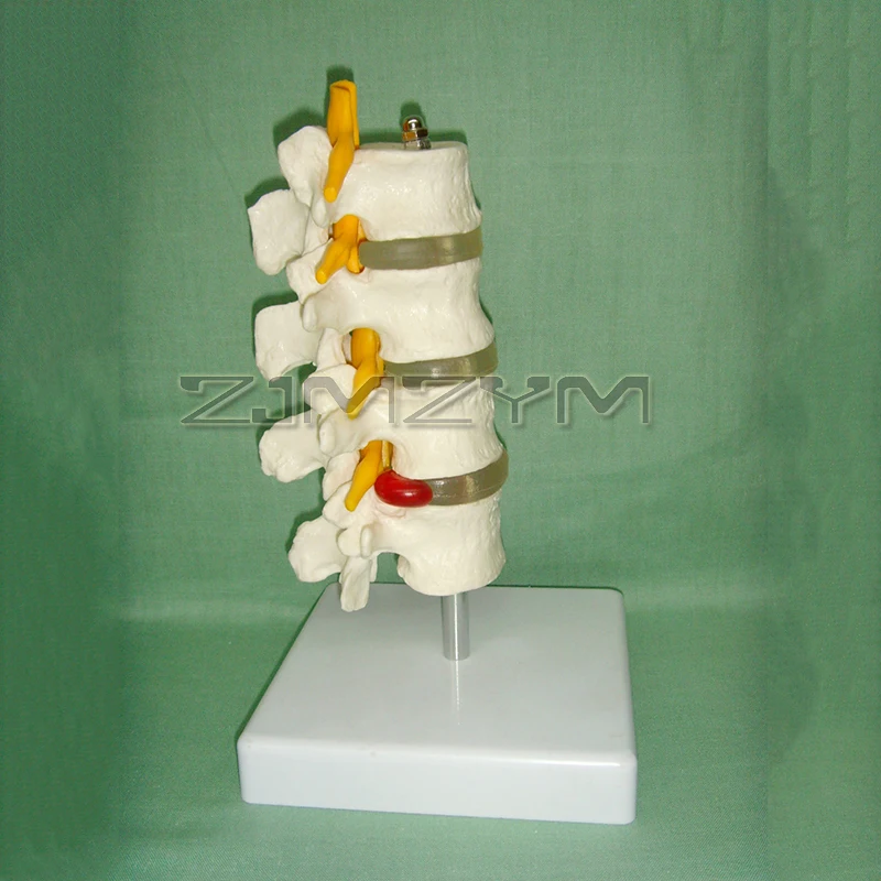 4Section Lumbar Spine Model Vertebrae Intervertebral Disc Skeleton Model Demonstration Educative Medical Teaching Training Tool