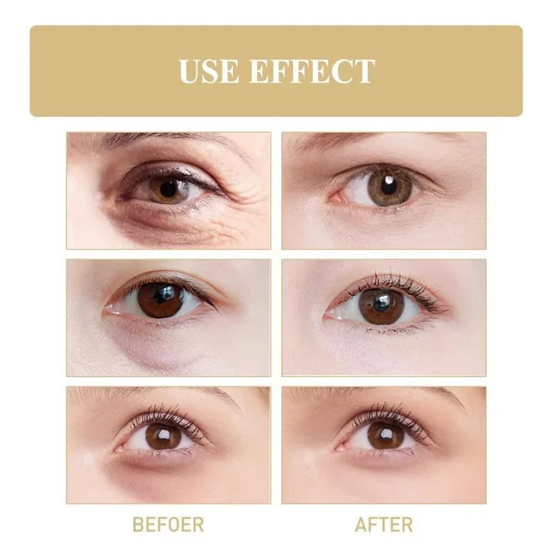 Crème anti-vieillissement pour les yeux, multi-effets, déformable, élimination des poches sous les yeux, resserre les poches, estompe les ridules, soins de la peau, beauté