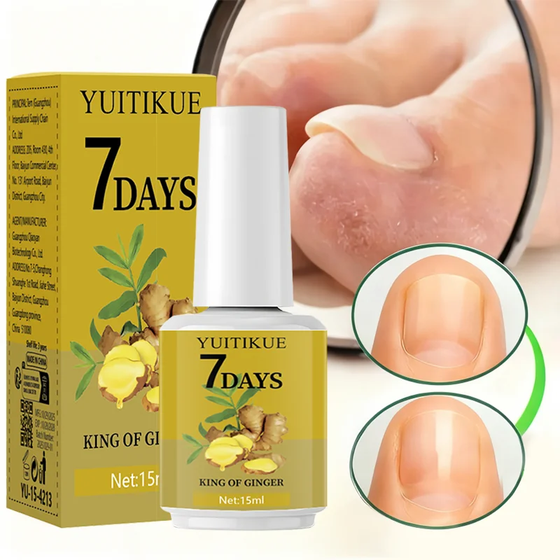 ยูอิทิคิว 7-เดย์ จินเจอร์ เนล แคร์ 15 มล. - ช่วยให้เล็บแข็งแรง เรียบเนียน และปกป้องเล็บ บำรุงหนังกำพร้าอย่างเข้มข้นเพื่อเล็บสวย