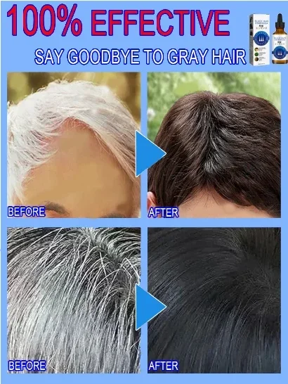 White hair killer, remove gray hair and restore natural hair color in 7 days