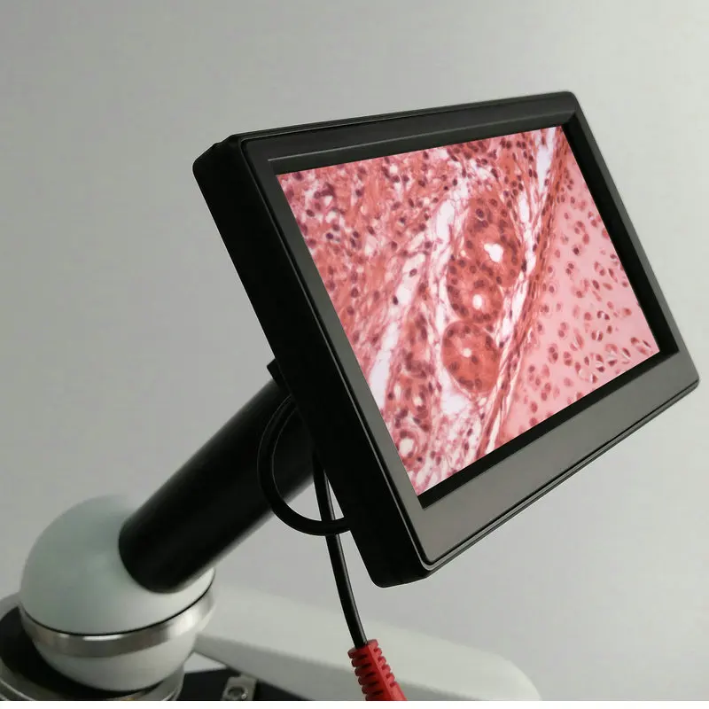 

5 Inches LCD Screen 2M Images for Biological Stereo Microscope