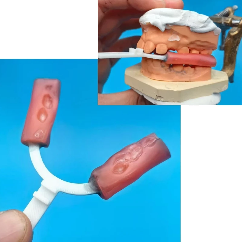 Dental Mandibular Extension Bite Fork TB Bite Fork Muscle Activator Bite Fork Prefabricated Bite Fork Exacto Twin Block