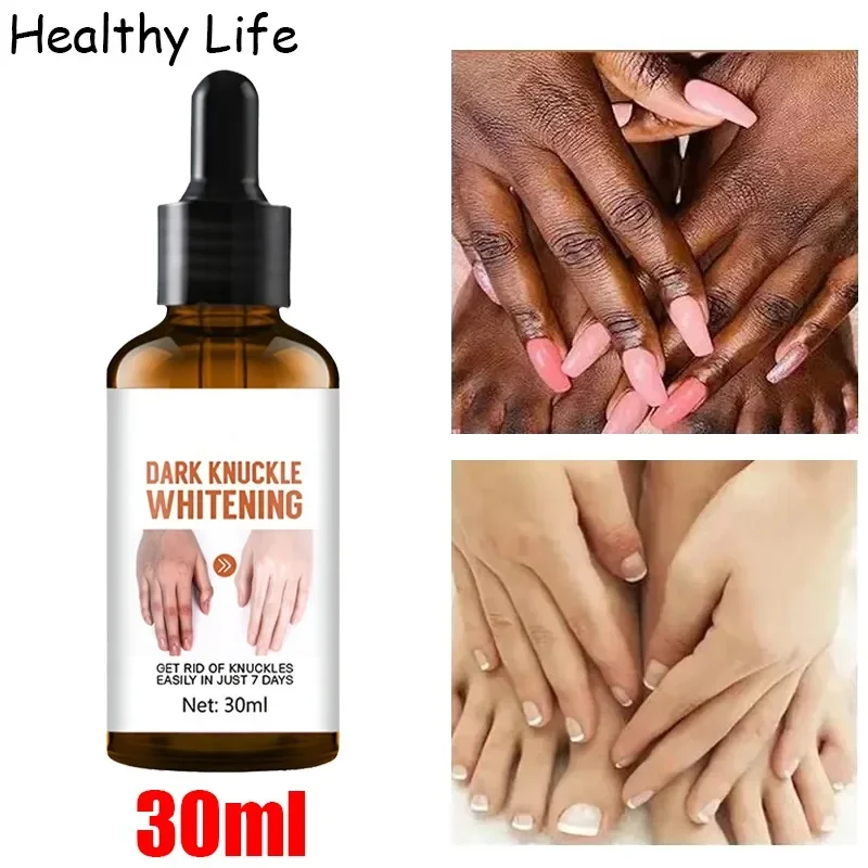 Remove Dark Skin Body Care Serum Private Parts Butt Bleaching Serum Underarm Knee Brighten Essence Inner Thigh Brightening Cream