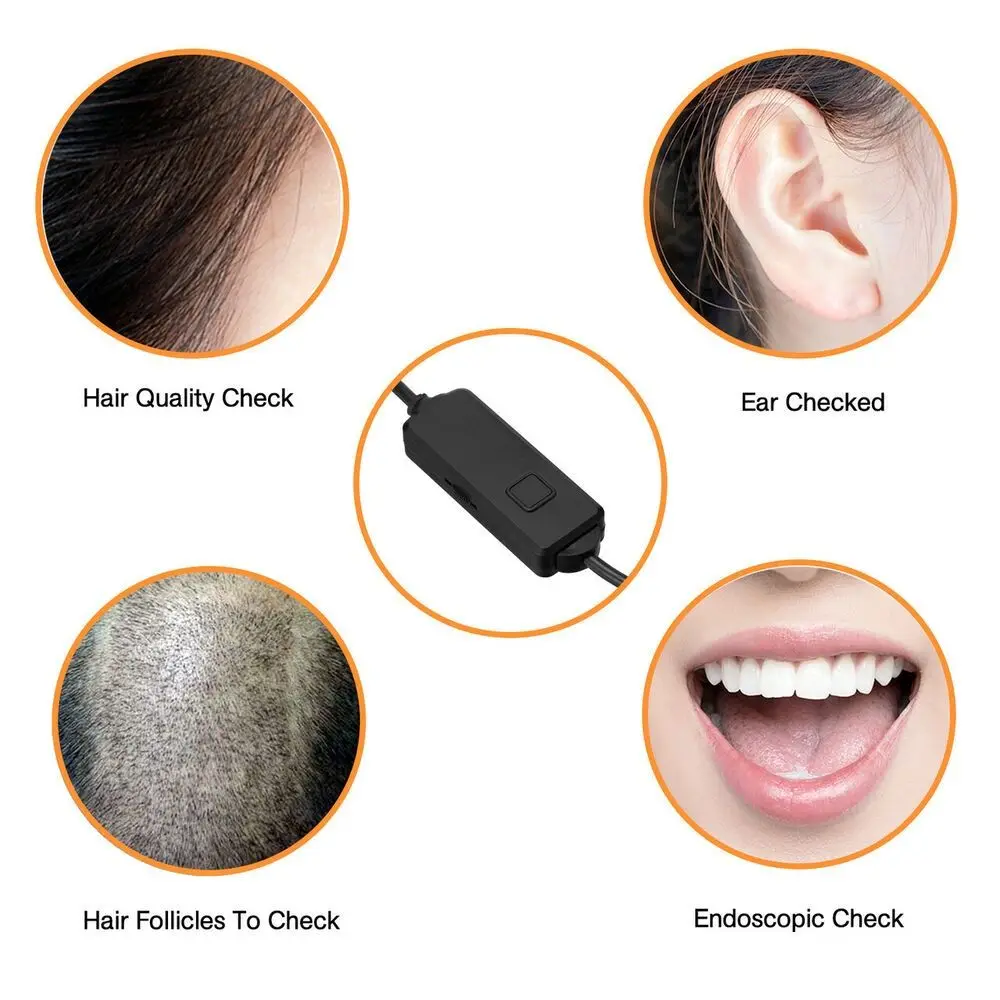 

Набор для удаления ушной серы, бороскоп, мобильный отоскоп, светодиодная эндоскопическая камера, ушная камера, камера для чистки ушей