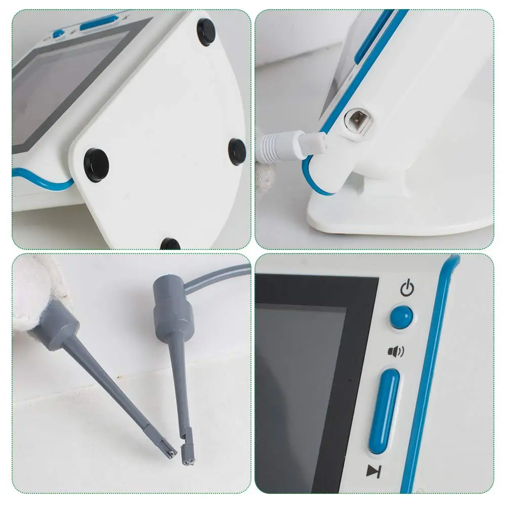 Рисунок 3 - Зубной эндоскоп, экран дисплея,