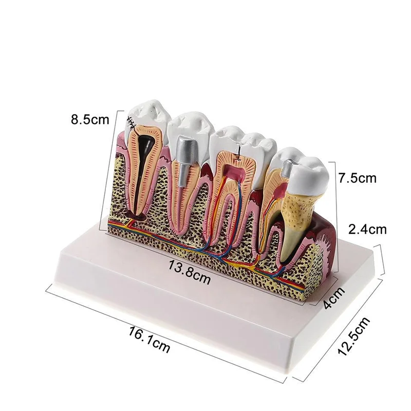 التشريحية القياسية الأسنان عن طريق الفم نموذج لشكل الأسنان التدريس شامل هيكل الأسنان طبيب الأسنان طالب مظاهرة