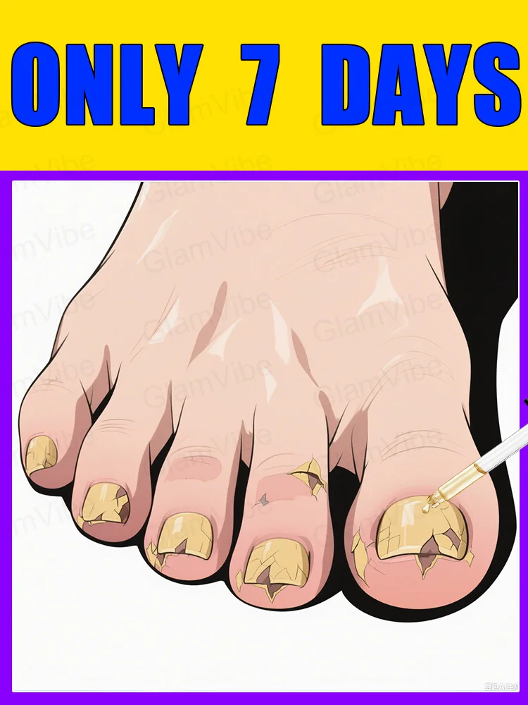 

2025 Toenail Fungus Patch Waterproof Nail Repair Patches Nail Ingrown Correction Sticker Discolored Damaged Nail Foot Care Tool