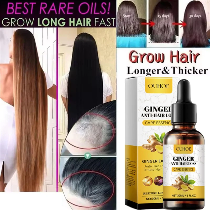 Ginger Hair Growth Essential Oil Anti-loss Hair Treatment Hair Regrowth Oil Fast Hair Promoting Regeneration Hair Care Women Men