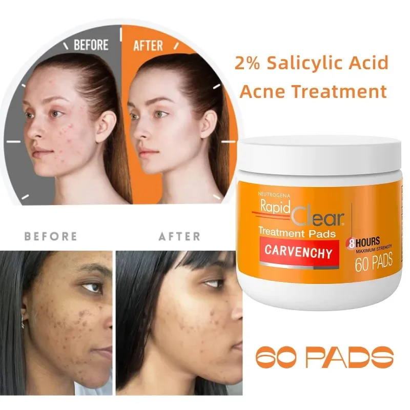 Rapid Clear Acne Face Pads 2% Salicylic Acid Acne Treatment Oil-Free Facial Cleansing Pads for Acne Skin Face Care Exfoliator