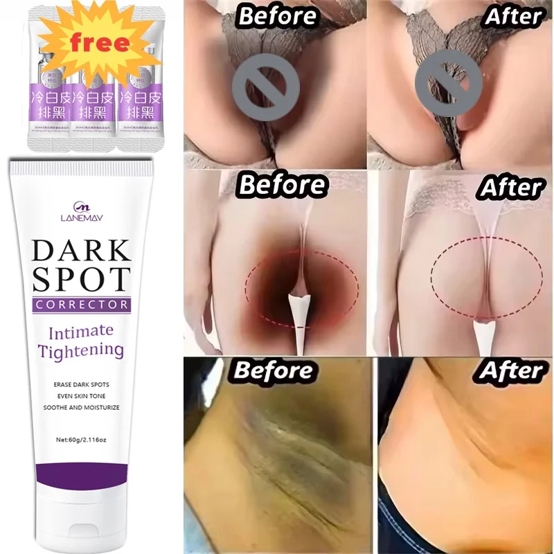 

Whitening Cream Private Parts Underarm Bleaching Serum Whiten Butt Knee Brighten Inner Thigh Intimate Parts Dark Remove Melanin