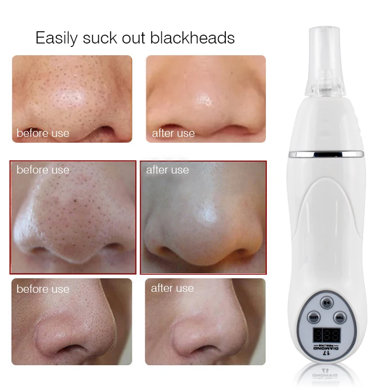 มือถือเพชร Microdermabrasion เครื่อง Facial Peeling ดูด Whitehead จมูก Blackhead Removal สิวทําความสะอาด Skin Care TOOL