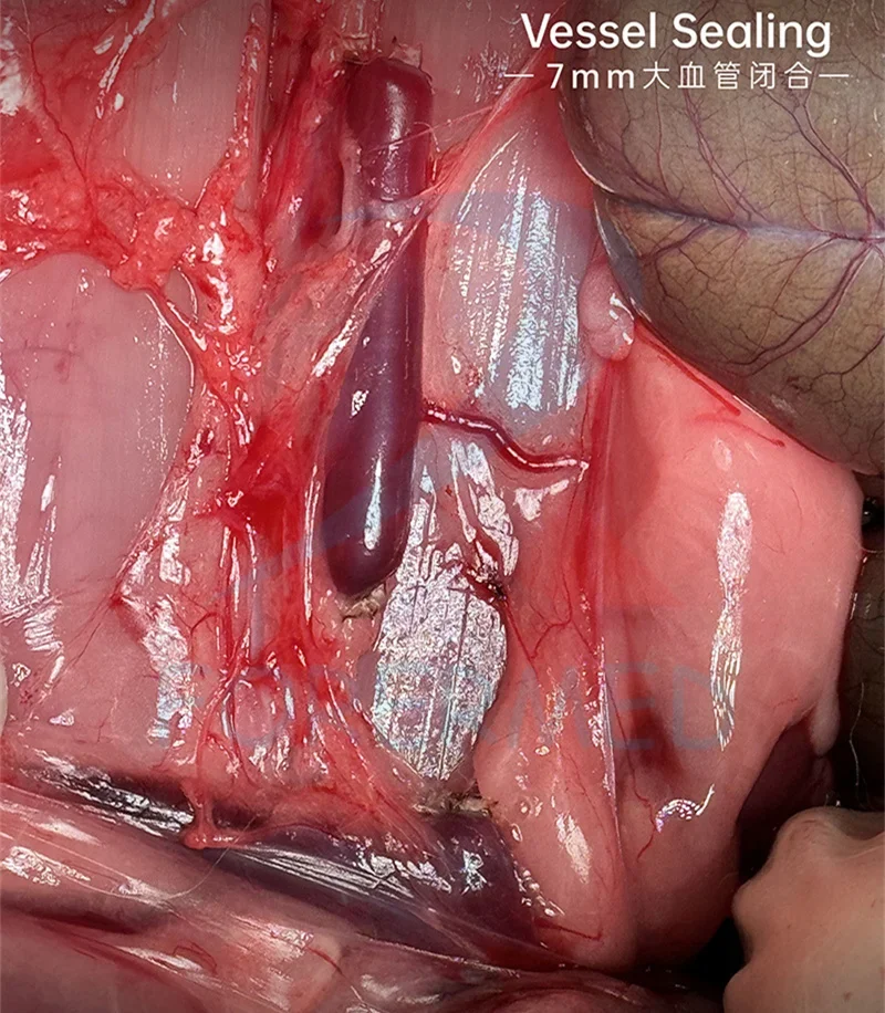 7 inch LCD Touch Screen 400w Electrosurgical Generator & Clear Color Indicators Cautery Machine High Frequency Electrotome