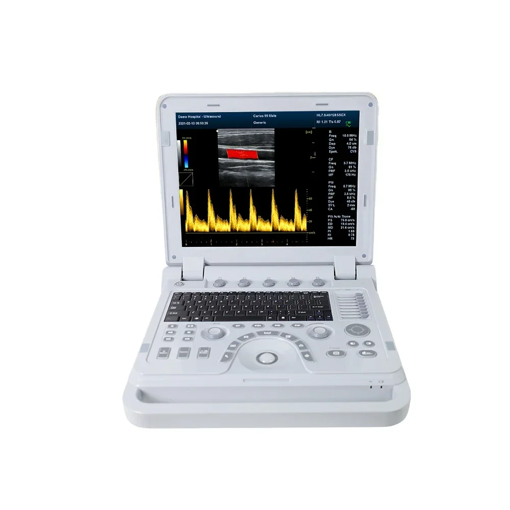 CONTEC CMS1700B-VET Portable Vet Ultrasonic Scanner Veterinary Ultrasound Bovine