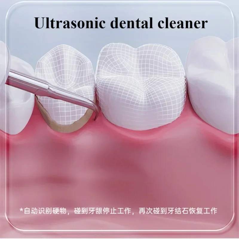 1-Ultrasonic scrubber tooth scrubber flushing calculus removal artifact tooth scrubber