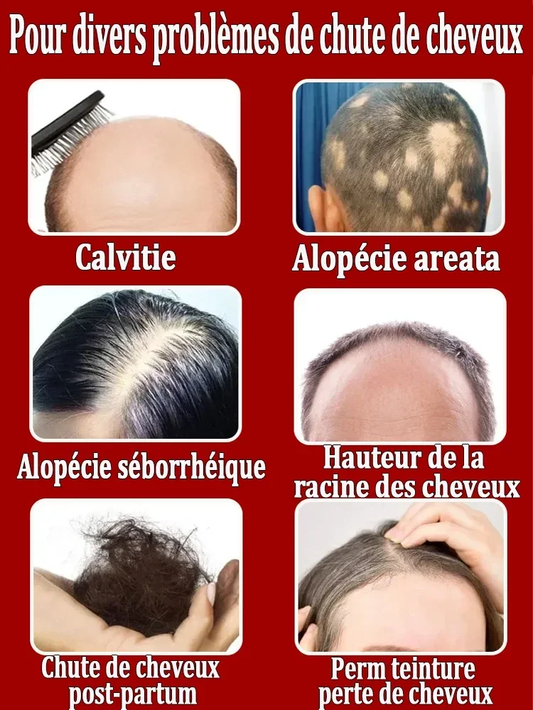 ¿Vamos decir adiós a la caída del cabello? Nuestros productos pueden penetrar los seguidores del cabello y ayudar a la regeneración del cabello.