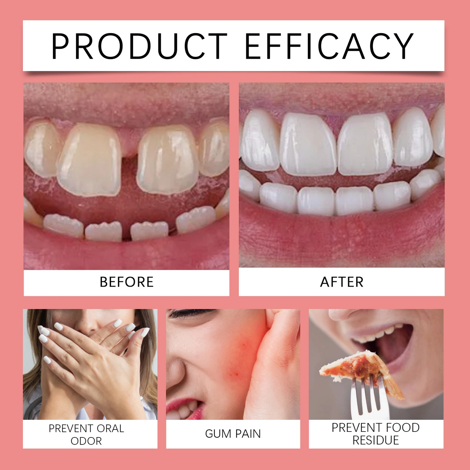 Zinc-Free Thermoplastic Denture Adhesive Refits and Tightens Dentures Great For Immediate And Temporary