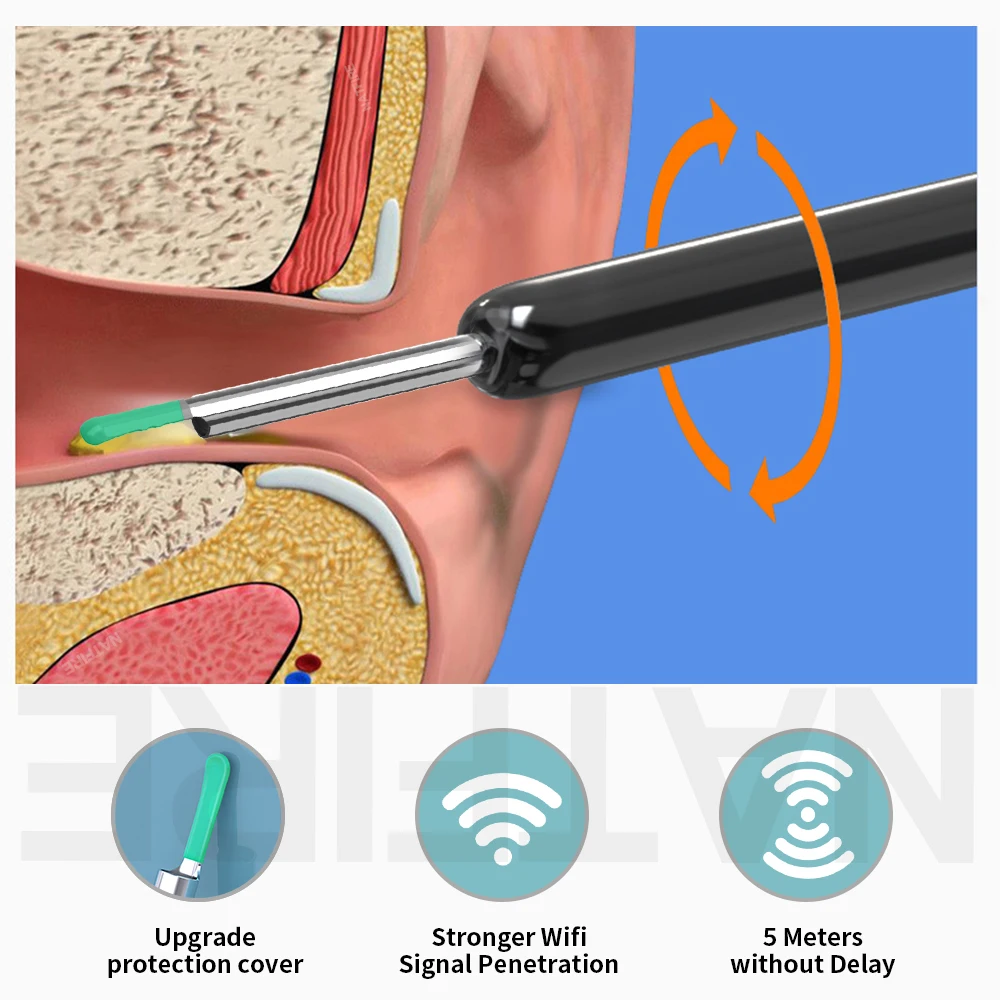 Limpiador de oídos inteligente con cámara, conexión WiFi, 6 luces LED, 3,6mm, Mini herramienta de eliminación de cera de oído con cámara, toma de